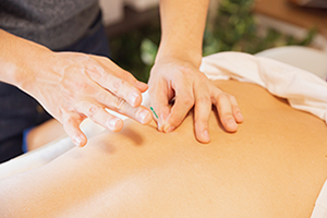 an acupuncture needle is placed in a back